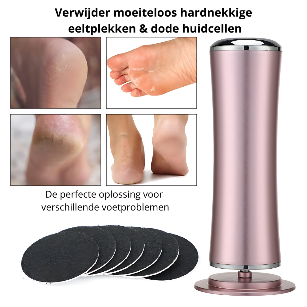 SmoothFoot™ | Verwijder moeiteloos eelt!