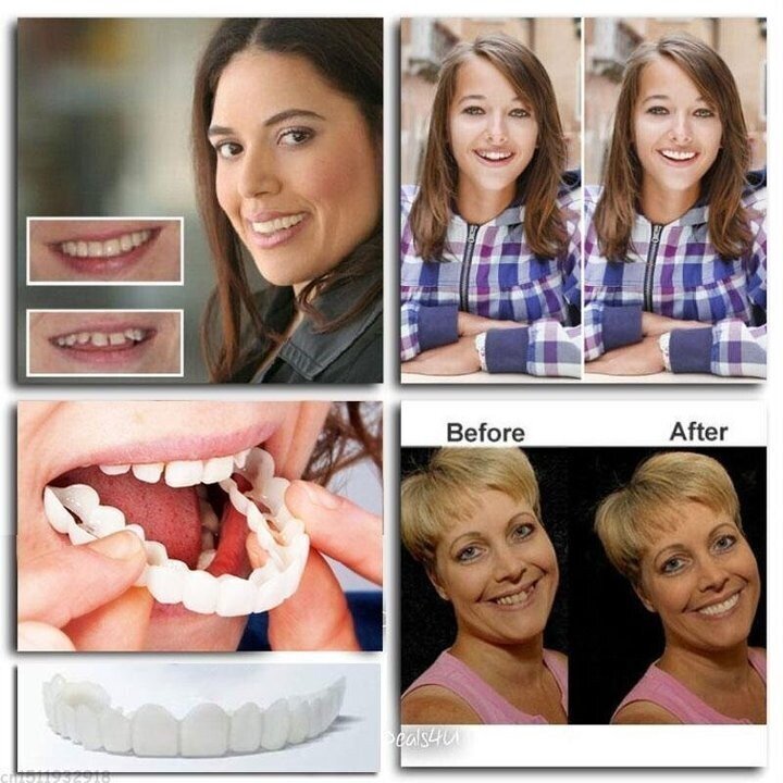 HappyBite ™ - adjustable dentures for a cheerful smile | Last day 75% discount